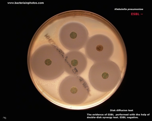 disk diffusion test: ESBL screening